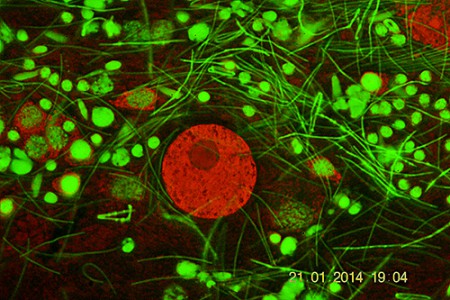 Protozoo parassita delle teche spermatiche di lombricus